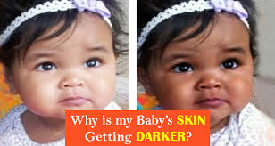 Baby S Skin Color And Effective Tips To Lighten And Whiten It