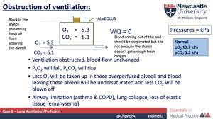 Ventilation Perfusion V Q Ratio