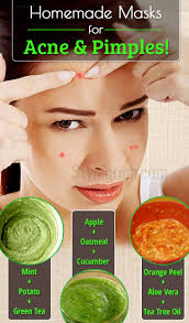 homemade masks to treat acne