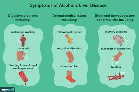 how long can you live with cirrhosis