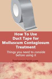 There is no cure, but molluscum contagiosum growths will eventually go away by themselves. Molluscum Contagiosum Duct Tape Home Remedy Treatment Healthy Lifestyle