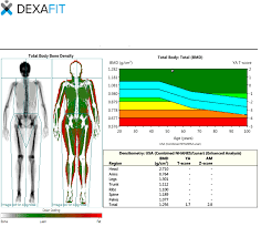 Dexa Scan A New Way To Track Your Body Composition Doused