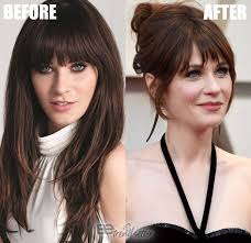 zooey deschanel plastic surgery the