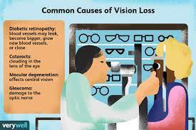 common causes of vision loss