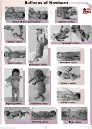Primitive Reflexes Primitive Reflexes Pediatric Physical