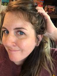 Is there anyway to make these hairs grow without surgery? Caitlin Hudon On Twitter Real Talk Thing Nobody Mentioned About Post Pregnancy That Awkward Phase When Your Baby Hairs Start Growing Back In