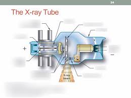 chapter 6 the xray diagram quizlet