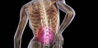 low back pain lbp welcome back