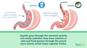 can liquids stretch your stomach after