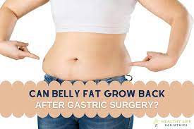 belly fat return after gastric surgery