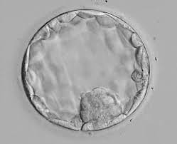 Embryo Grading How Do You Choose An Embryo For Ivf