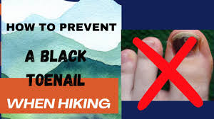 how to prevent a black toenail while