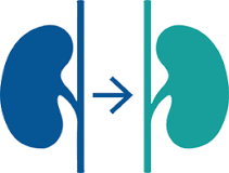 Image result for icd 10 code for kidney transplant evaluation