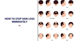 how to stop hair fall imately