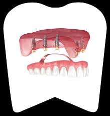 strauman osstem implant bahcelievler