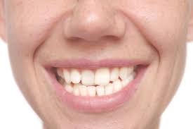 options to improve an uneven smile line