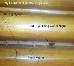 bed bugs horrible bite pictures and