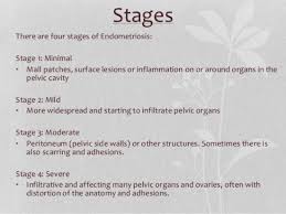 We did not find results for: Endometriosis Stages And How They Are Measured