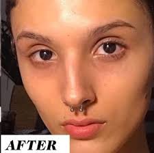 this woman s before and after retinol