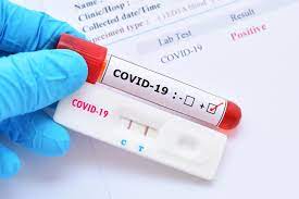 Testing is available regardless of your citizenship/immigration status. Swabs Antibodies Wait Times And More What Is The Covid 19 Test Actually Like Impacct Brooklyn