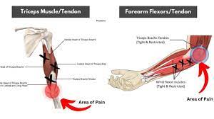 elbow pain during bicep curl