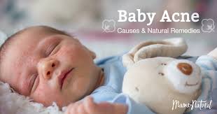 baby acne what causes it how to