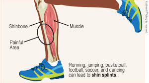 shin splints get set go fitness