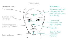 Image Result For Chemical Peel Strength Chart Microblading