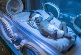Newborn Jaundice Causes Treatment Symptoms Signs
