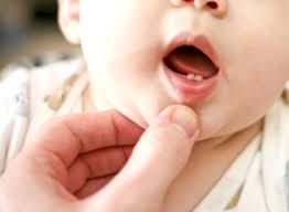 Mit dem baby zum zahnarzt? Die Ersten Zahne