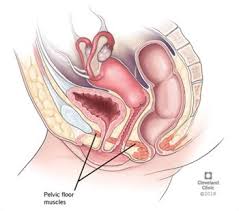 pelvic floor muscle dysfunction pfmd