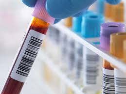 Lipase Test What Is It Results And Lowering Levels
