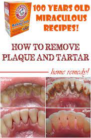 It is not good to have it, because it can damage your teeth. Home Remedies To Remove Plaque And Tartar Beauty Tips Diary Teeth Health Oral Health Care Dental Health