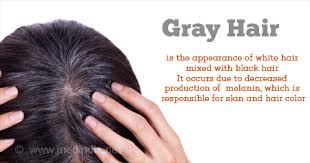 Have no idea what happened :'(* hello gorgeous 🙂. Home Remedies For Gray Hair