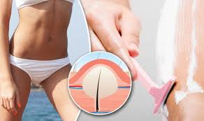 The skin tissue of the inner thigh near the groin is usually. How To Get Rid Of Ingrown Pubic Hair Easy To Use And Natural Home Remedies For Removal Express Co Uk