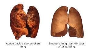 Pin On Quit Smoking