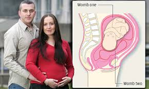 Image result for two wombs