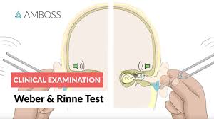 Weber And Rinne Test Clinical Examination