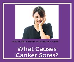 what causes canker sores broomfield