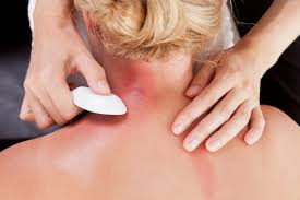 Gua sha: Scraping of back is said to relieve pain and ease other medical  problems - The Washington Post