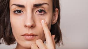 4 things that can cause itchy eyes