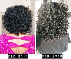 Vitamins play a role in hair health, but can they reduce hair loss? Bounce Curl Hair Vitamins With Nigella Sativa Black Seed Oil