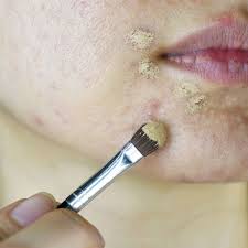 best foundation for acne e skin