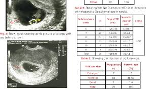 Table 3 From Size Of Yolk Sac By Ultrasonography And Its