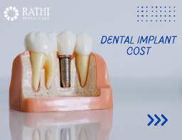 tooth implant cost in thane