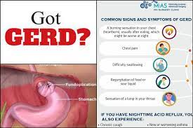 gerd gastroesophageal reflux disease