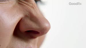 3 common reasons your nose is stuffed