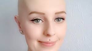 mastectomy at age 24 proves cancer