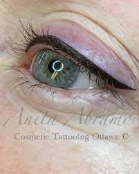 estetica ottawa cosmetic tattooing