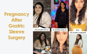 pregnancy after gastric sleeve surgery
